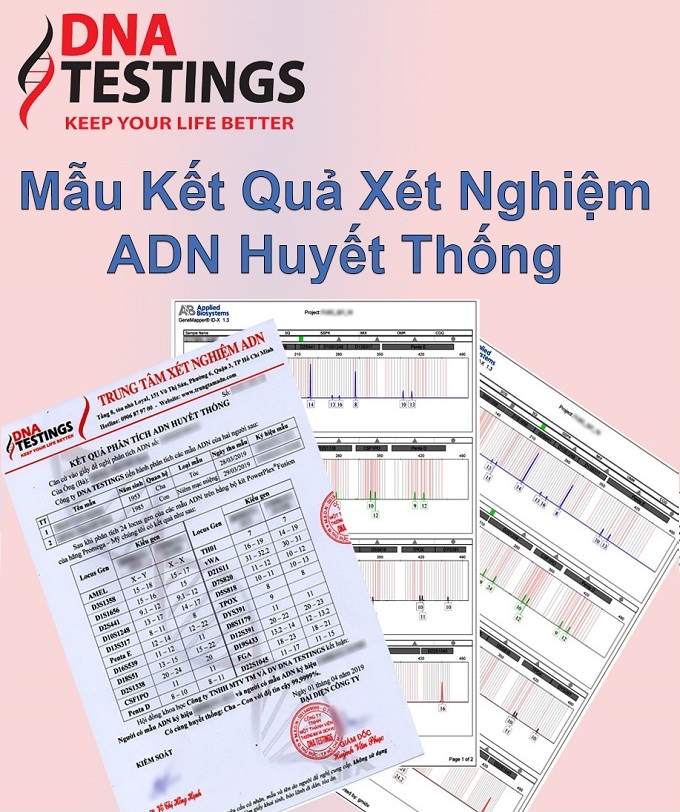 Giấy xét nghiệm ADN